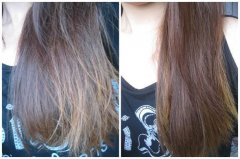 护发不当变秃头 警惕护发8大误区